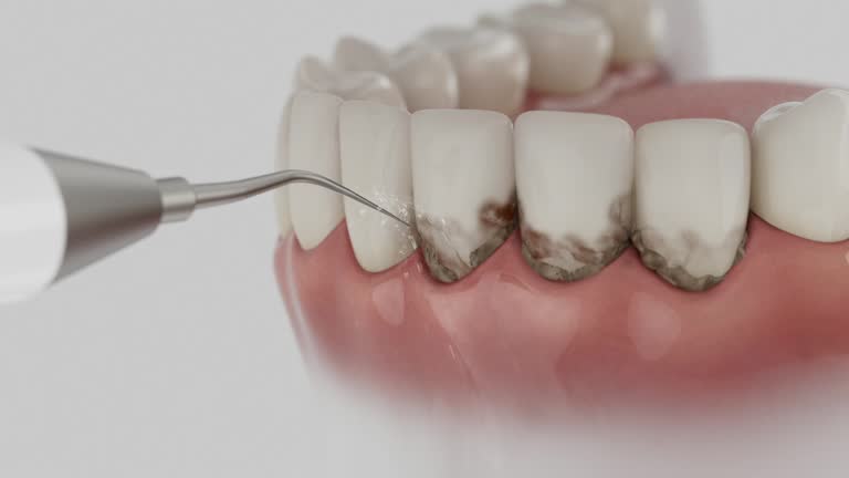 Reliable Dental Implants contractor in Preston, TX by Smile Center Dentistry